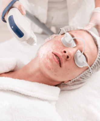 face treatment